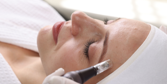 Microneedling, Aquabration